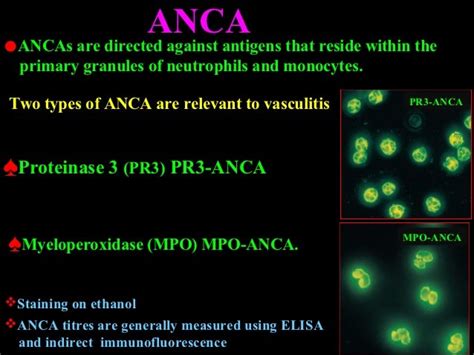 PR-3/c-anca and MPO/p-anca | Student Doctor Network