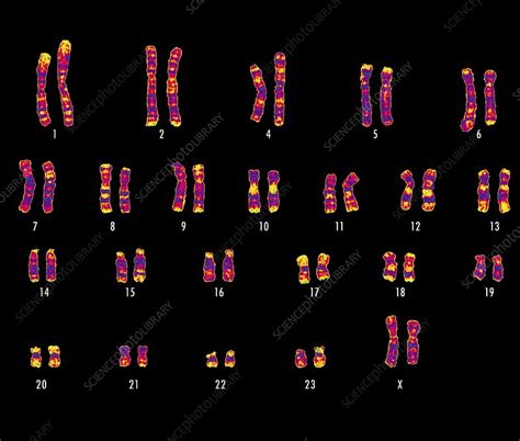 Human female karyotype - Stock Image - C001/8379 - Science Photo Library