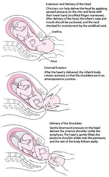 Management of Normal Delivery - Gynecology and Obstetrics - Merck Manuals Professional Edition