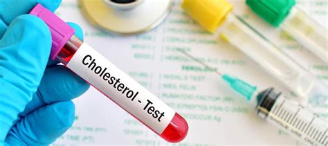 Image: Research suggests a HDL-C function test could improve risk ...