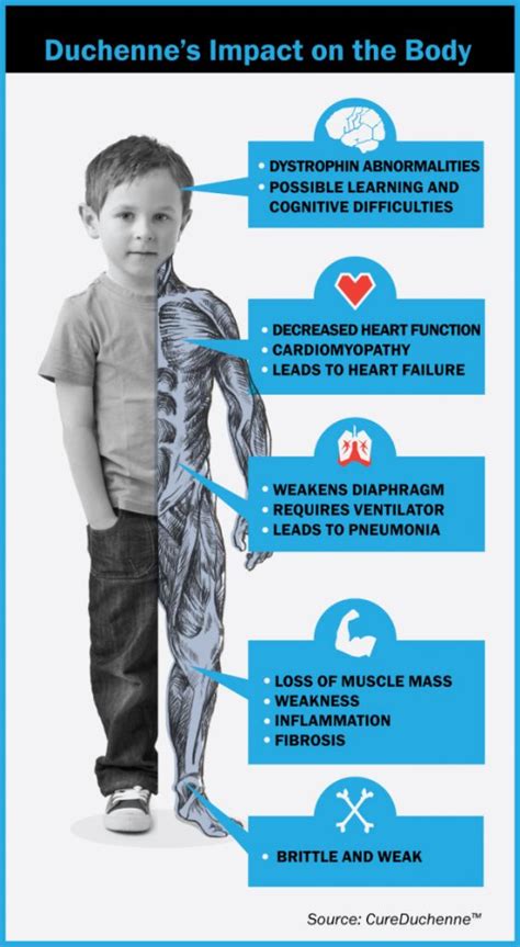 What is Duchenne? | CureDuchenne | CureDuchenne