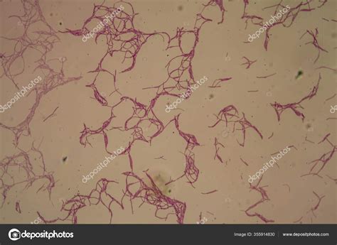 Bacillus Anthracis Anthrax Microscope 200X Stock Photo by ©dr.lange ...