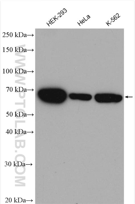 HSPA1B antibody (25405-1-AP) | Proteintech