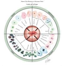 Abnormal Pap Smear: ASCUS or AGCUS Cervical Cell Pathology in Squamous Tissue