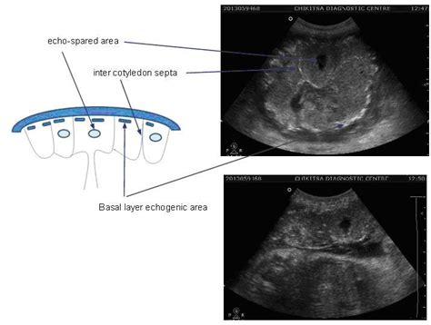 Ultrasoundtraining | Ultra soundinstitute | Sonography Courses | Mumbai ...