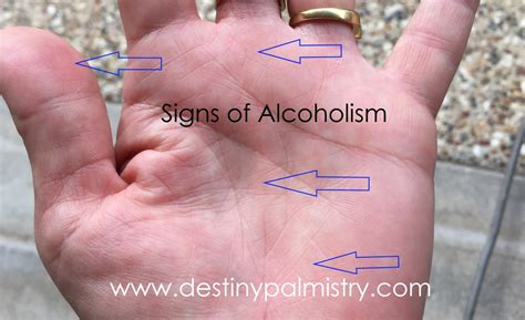 Signs of Alcoholism in Palmistry? - Destiny Palmistry