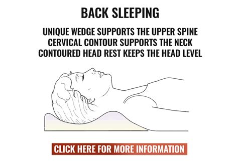 Occipital Neuralgia Sleeping Neck Nuchal Rigidity Per - vrogue.co