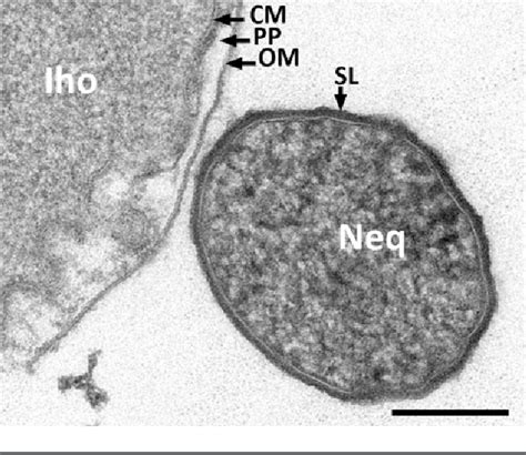 Figure 1 from The interaction of Nanoarchaeum equitans with Ignicoccus hospitalis: proteins in ...