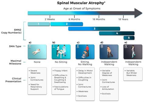 Spinal muscular atrophy types, causes, symptoms, diagnosis & treatment