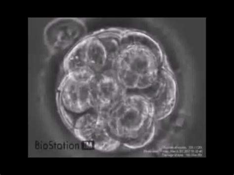 Zygote division - YouTube
