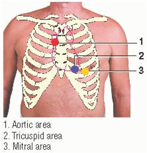 Other Auscultatory Sounds | Thoracic Key