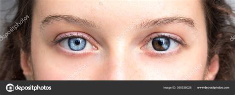 Human Heterochromia Eyes Girl Blue One Brown One Stock Photo by ©sruilk ...