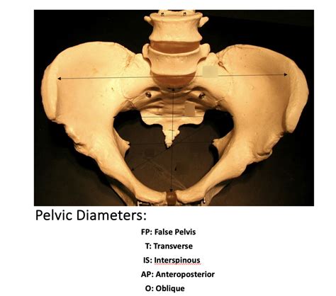 pelvic diameters Diagram | Quizlet