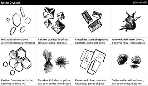 Tyrosine Crystals In Urine