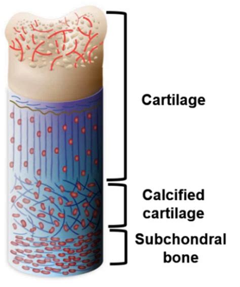 A schematic diagram of the OC with three zones including cartilage,... | Download Scientific Diagram