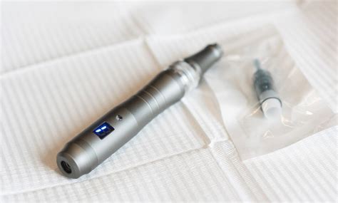 Micro-Needling - Kalon Laser Aesthetics | Groupon