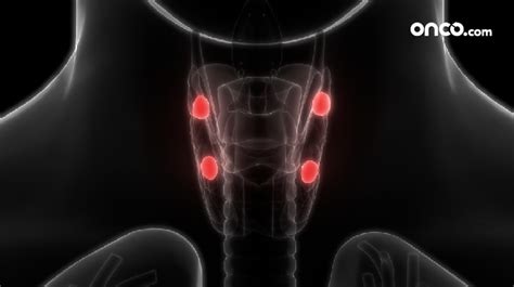 Throat cancer staging - Hypopharyngeal cancer | Onco.com