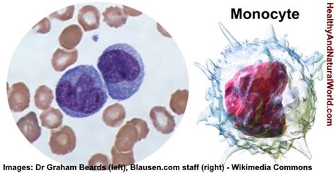 High or Low Monocytes in Blood Test - What Does It Mean?