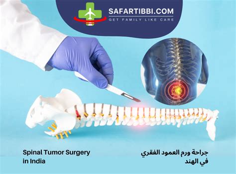 Comprehensive Guide to Spinal Tumor Surgery in India | Safartibbi