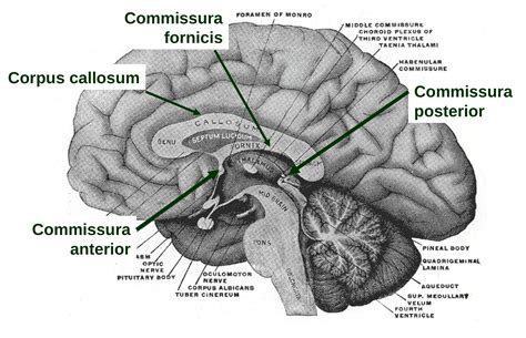 Split-Brain-Patienten - Das doppelte Ich