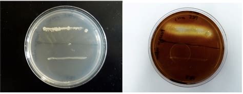 Starch Hydrolysis Test Lectures, Microbiology - on Study Boss