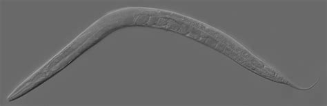 Caenorhabditis elegans - Wiki; Image ONLY