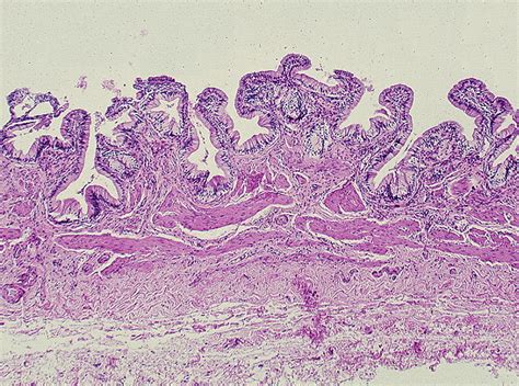 Pathology Outlines - Histology-gallbladder