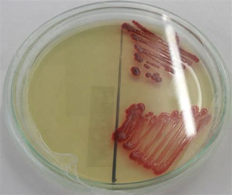 Serratia - wikidoc