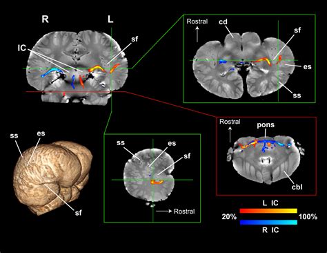 First images of dolphin brain circuitry hint at how they sense sound