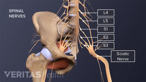 Pinched Nerve In Leg