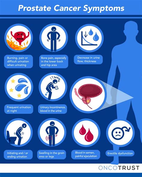 Things to Know About Prostate Cancer: Symptoms, Diagnosis, and Treatment | OncoTrust