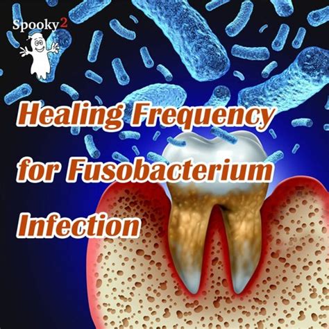 Stream Healing Frequency for Fusobacterium Infection - Spooky2 Rife Frequency Healing by Spooky2 ...