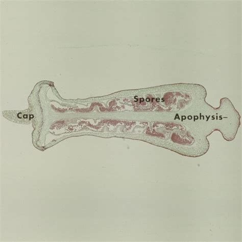 Moss Protonema, w.m. Microscope Slide | Carolina.com