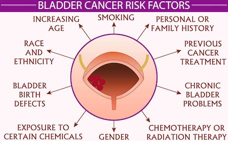 Bladder Cancer – To Catch It in Early Stages, Know These Risk Factors ...