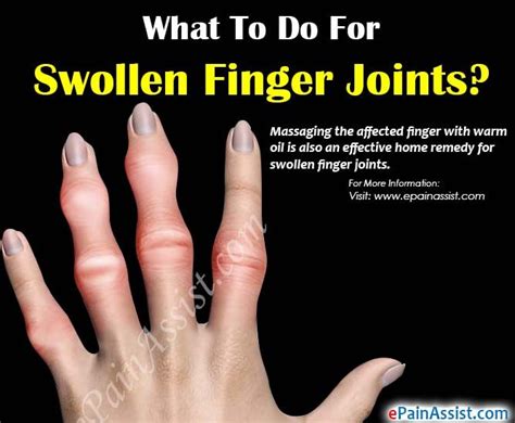 What Causes Finger Joints To Swell And Hurt