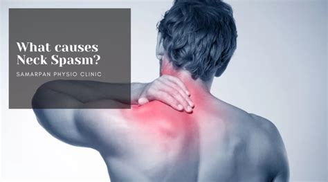 Muscle Spasm on Neck: Cause, Symptoms, Treatment & Exercise – Physical Therapy Treatment & Exercise