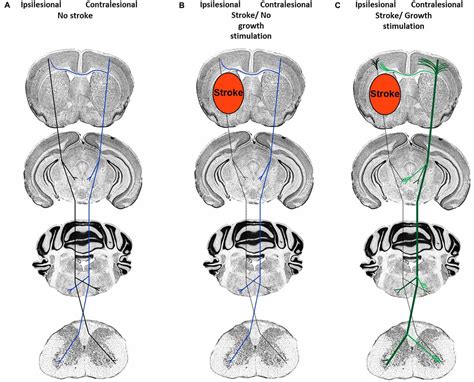 Frontiers | Correlates of Post-Stroke Brain Plasticity, Relationship to Pathophysiological ...