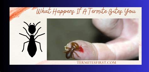 What Do Termite Bites Look Like? Symptoms & Treatment