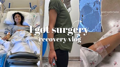 getting a cystic tumor surgically removed 🏥 | recovery vlog - YouTube