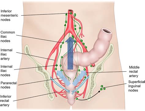 Frontiers | Clinical implication and management of rectal cancer with clinically suspicious ...