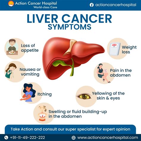 Liver Cancer Symptoms, Causes, Types, Complications,, 49% OFF