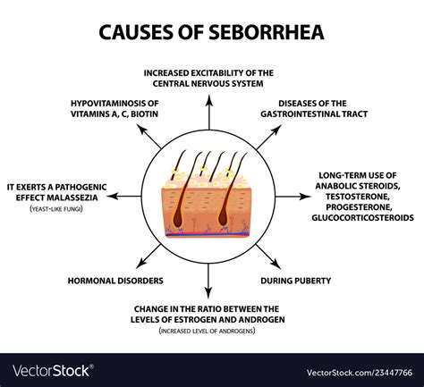 Causes seborrhea seborrhea skin and hair Vector Image