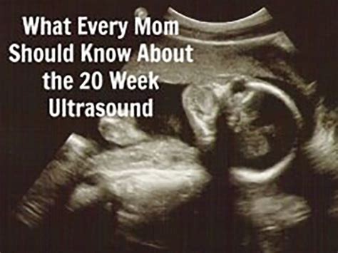 20 Weeks Ultrasound