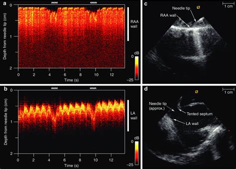 All-optical ultrasound imaging (M-mode) before (a) and after (b) the... | Download Scientific ...