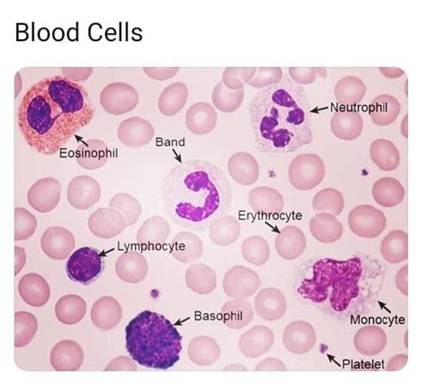 Hematology Society HS Blood Cells In Peripheral Blood Smear, 41% OFF