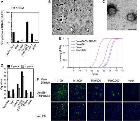 Enhanced isolation of SARS-CoV-2 by TMPRSS2-expressing cells | PNAS