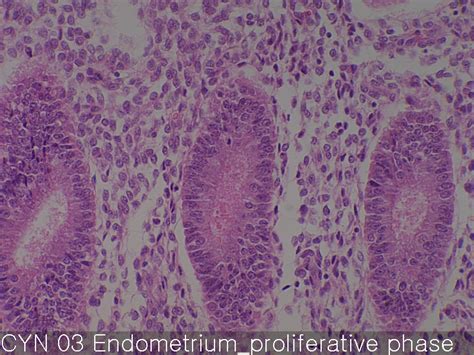 Normal endometrium | Xelonet