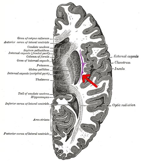 What Is Going On In Your Brain When You Sleep? | IFLScience | Internal capsule, Anatomy