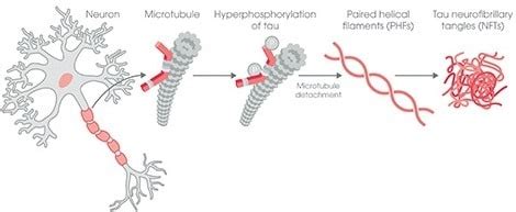 Untangle tau with our guide | Abcam