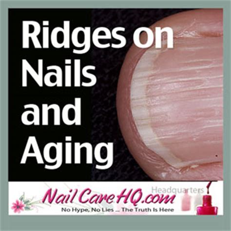 Ridges-On-Nails-and-Aging-Brittle-Nails - Nail Care HQ